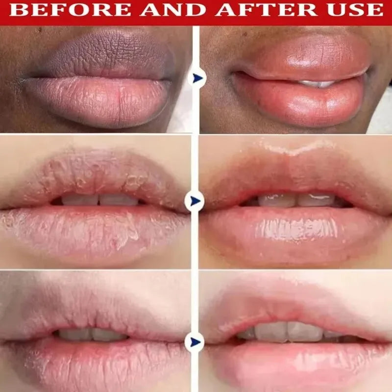 Lustra Lips