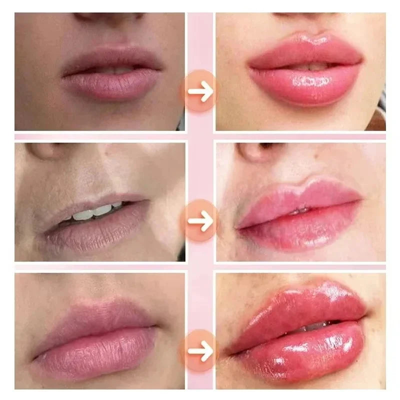 Lips-pump