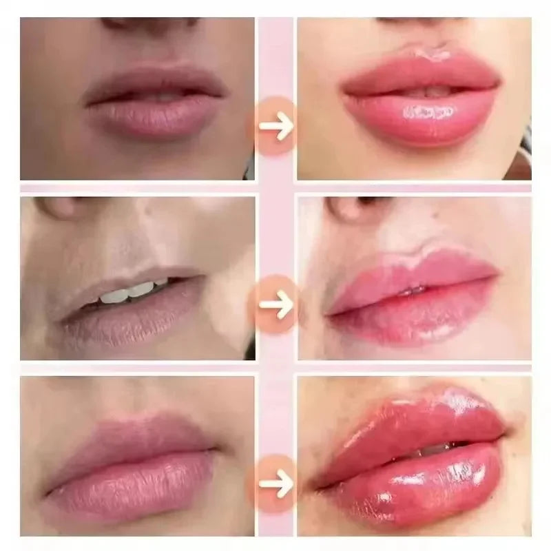 Lips-pump
